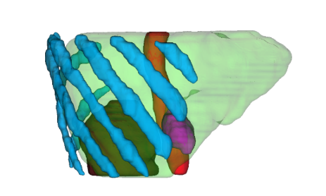 Three-dimensional anatomical model showing ribs and the liver region used for ultrasound–MRI alignment.